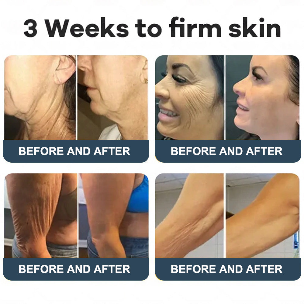 Labolab® USP Bee Venom & Wild Yam Repair Cream For Hormonal Balance, Anti-aging, Hydrating, Skin Repair, Even Tone, Preventing frostbite，Acne and Dark Spot Treatment, Wart and Mole Removal, Psoriasis Relief