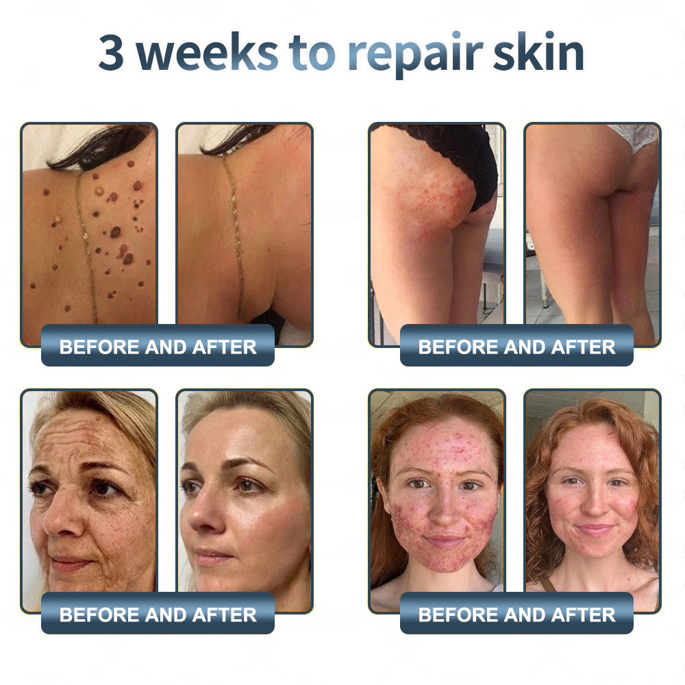 Labolab® USP Bee Venom & Wild Yam Repair Cream For Hormonal Balance, Anti-aging, Hydrating, Skin Repair, Even Tone, Preventing frostbite，Acne and Dark Spot Treatment, Wart and Mole Removal, Psoriasis Relief