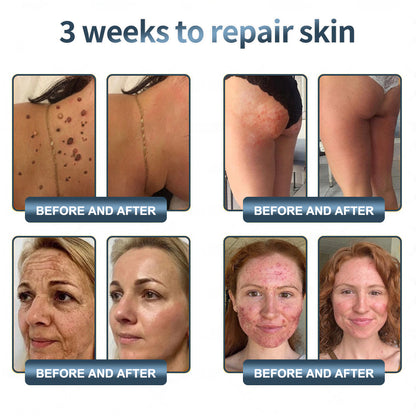 Labolab® USP Bee Venom & Wild Yam Repair Cream For Hormonal Balance, Anti-aging, Hydrating, Skin Repair, Even Tone, Preventing frostbite，Acne and Dark Spot Treatment, Wart and Mole Removal, Psoriasis Relief