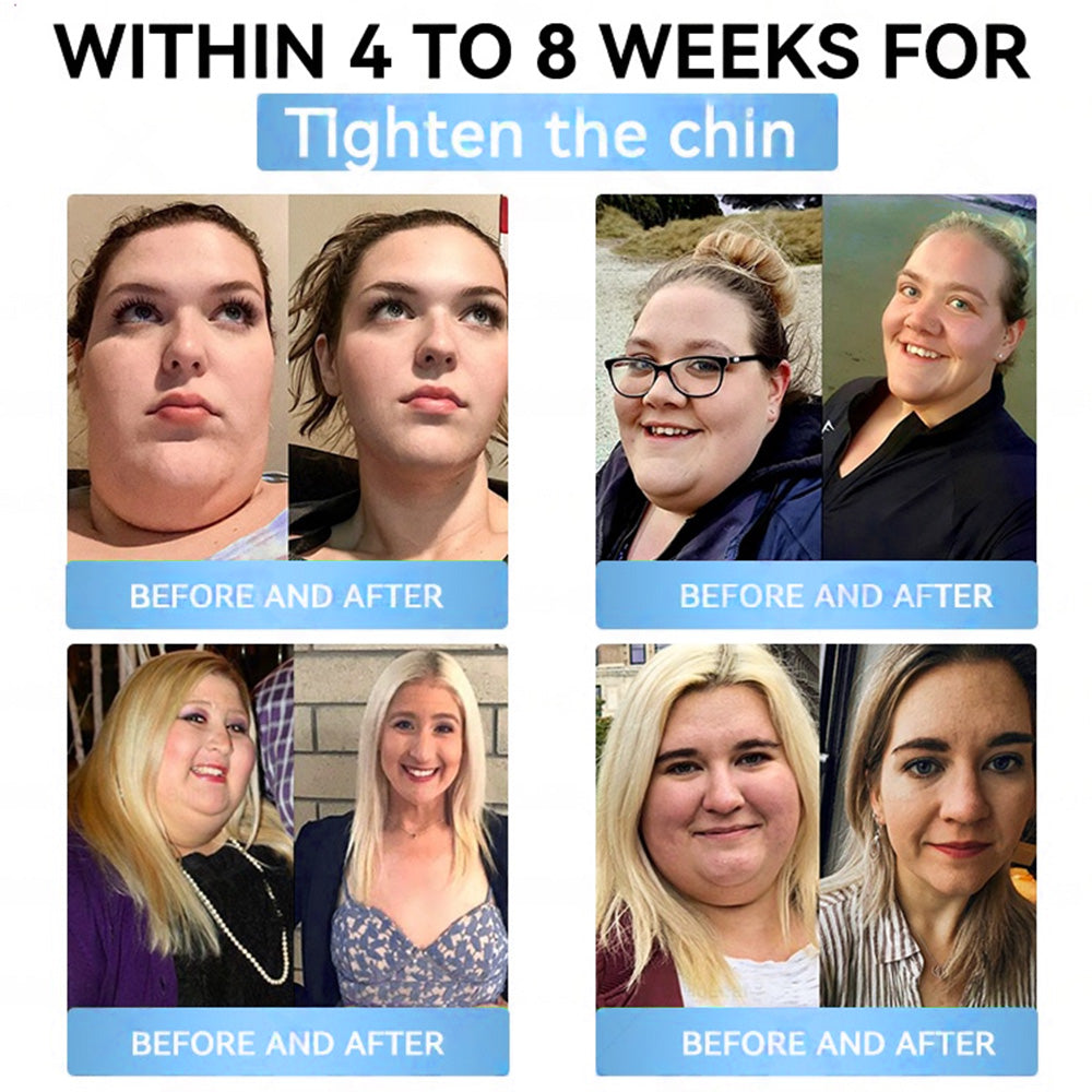 CVS Online Store | Myo Clinic Longevity GLP-1 8-in-1 Slim & Healthy Oral Solution(Once a day, visible results in 7 days) Supports obesity, cardiovascular health, diabetes, sleep apnea, gut health, joint issues, while also firming the skin