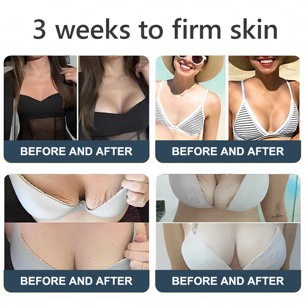 Labolab® USP Bee Venom & Wild Yam Repair Cream For Hormonal Balance, Anti-aging, Hydrating, Skin Repair, Even Tone, Preventing frostbite，Acne and Dark Spot Treatment, Wart and Mole Removal, Psoriasis Relief