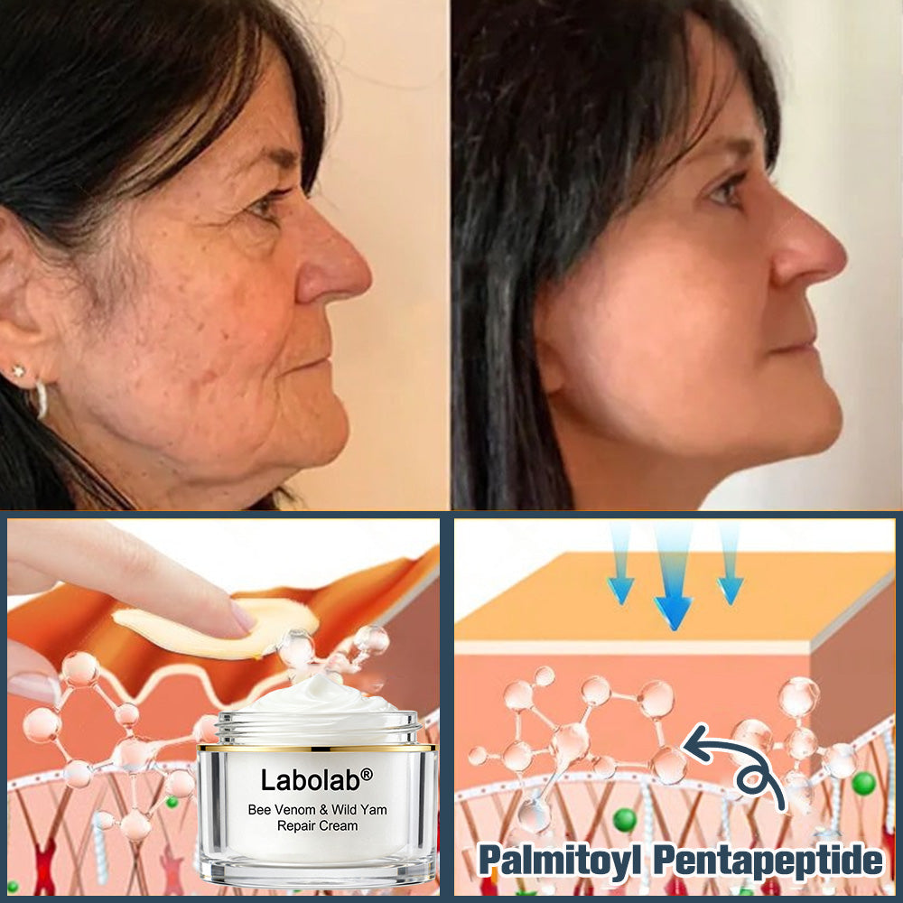Labolab® USP Bee Venom & Wild Yam Repair Cream For Hormonal Balance, Anti-aging, Hydrating, Skin Repair, Even Tone, Preventing frostbite，Acne and Dark Spot Treatment, Wart and Mole Removal, Psoriasis Relief