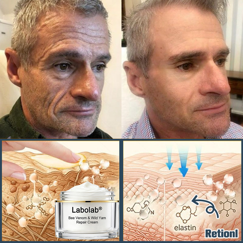 Labolab® USP Bee Venom & Wild Yam Repair Cream For Hormonal Balance, Anti-aging, Hydrating, Skin Repair, Even Tone, Preventing frostbite，Acne and Dark Spot Treatment, Wart and Mole Removal, Psoriasis Relief