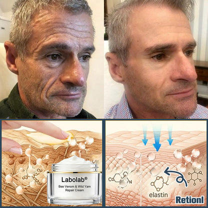 Labolab® USP Bee Venom & Wild Yam Repair Cream For Hormonal Balance, Anti-aging, Hydrating, Skin Repair, Even Tone, Preventing frostbite，Acne and Dark Spot Treatment, Wart and Mole Removal, Psoriasis Relief