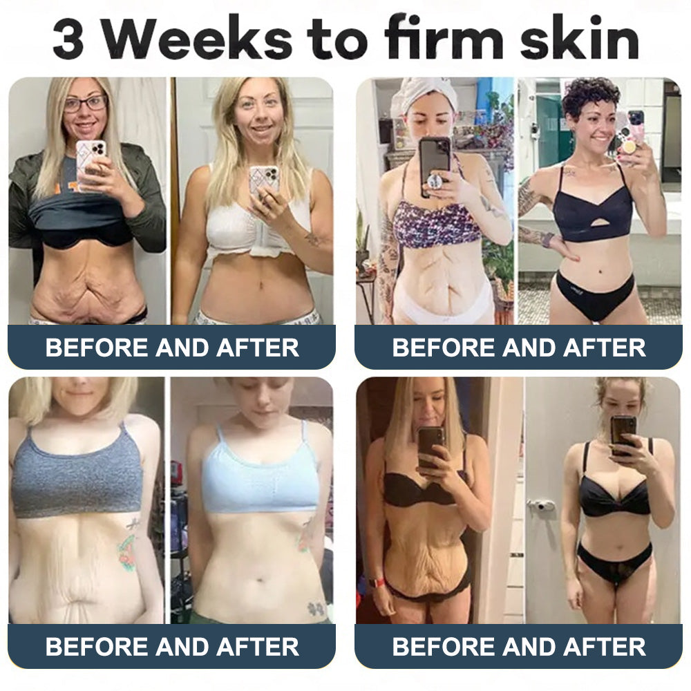 Labolab® USP Bee Venom & Wild Yam Repair Cream For Hormonal Balance, Anti-aging, Hydrating, Skin Repair, Even Tone, Preventing frostbite，Acne and Dark Spot Treatment, Wart and Mole Removal, Psoriasis Relief